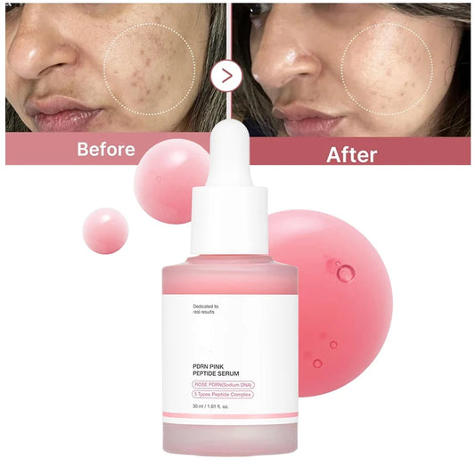 Peptide collagen serum Remove Acne Essence Enhances Skin Radiance Provides Deep Hydration Smooths Skin Texture  Korean products