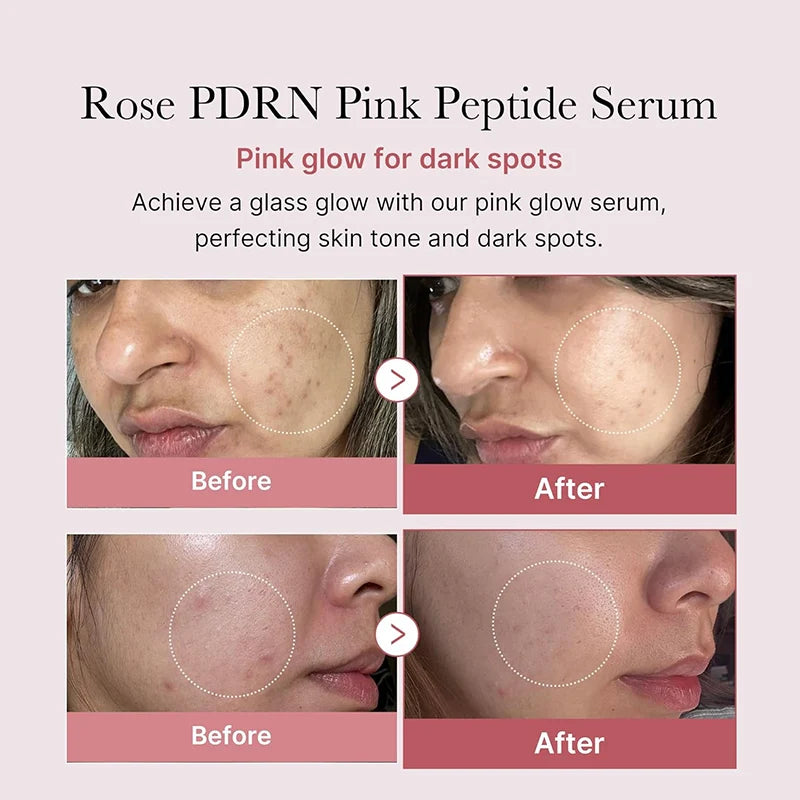 Serum Peptide collagène